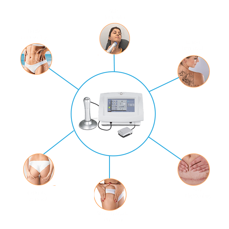 Filly Investment Slimspec Treatment Application